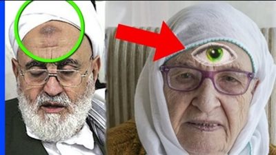 لماذا لا تظهر علامة السجود على جبين المرأة المسلمة..  بينما تظهر على جبين الرجل 